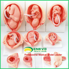 ANATOMY13 (12451) Natürliche Größe 10in1 Entwicklungsprozess für Fetus, Anatomie Modelle&gt; Schwangerschaftsmodelle 12451